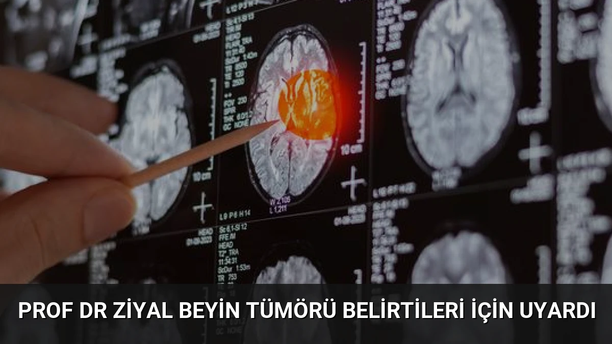 Prof Dr Ziyal Beyin Tümörü Belirtileri İçin Uyardı