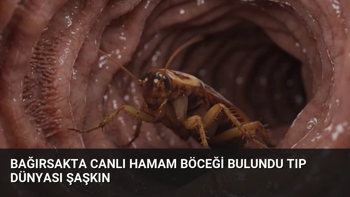 Bağırsakta Canlı Hamam Böceği Bulundu Tıp Dünyası Şaşkın
