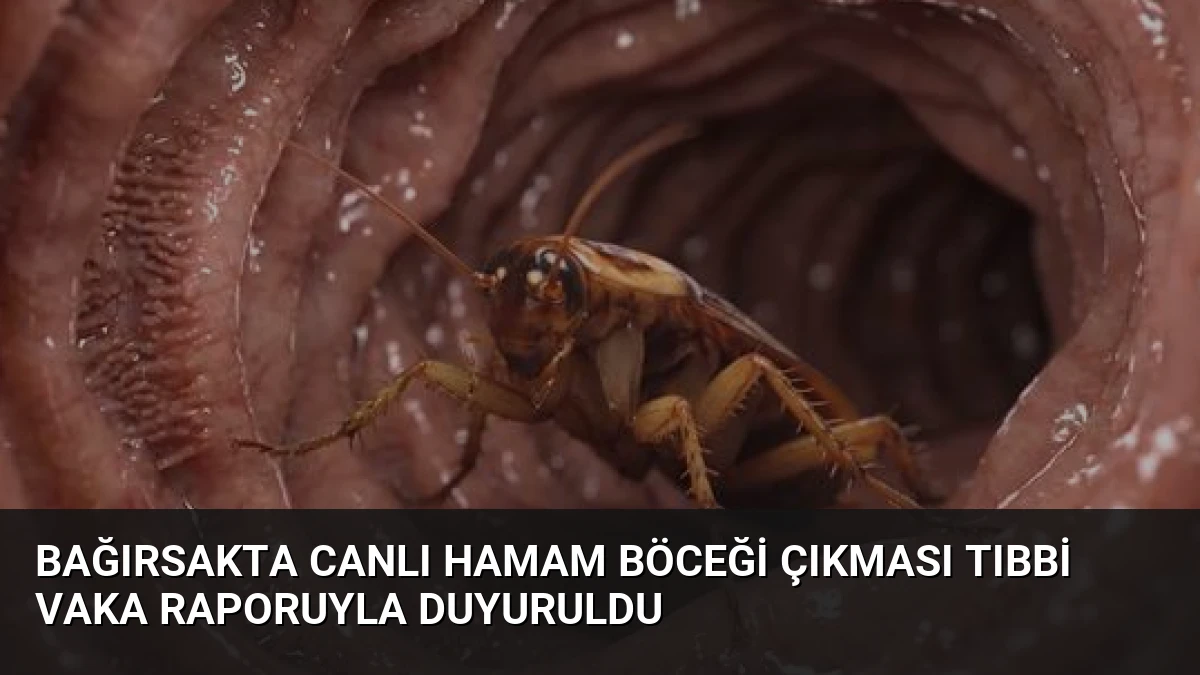 Bağırsakta Canlı Hamam Böceği Çıkması Tıbbi Vaka Raporuyla Duyuruldu