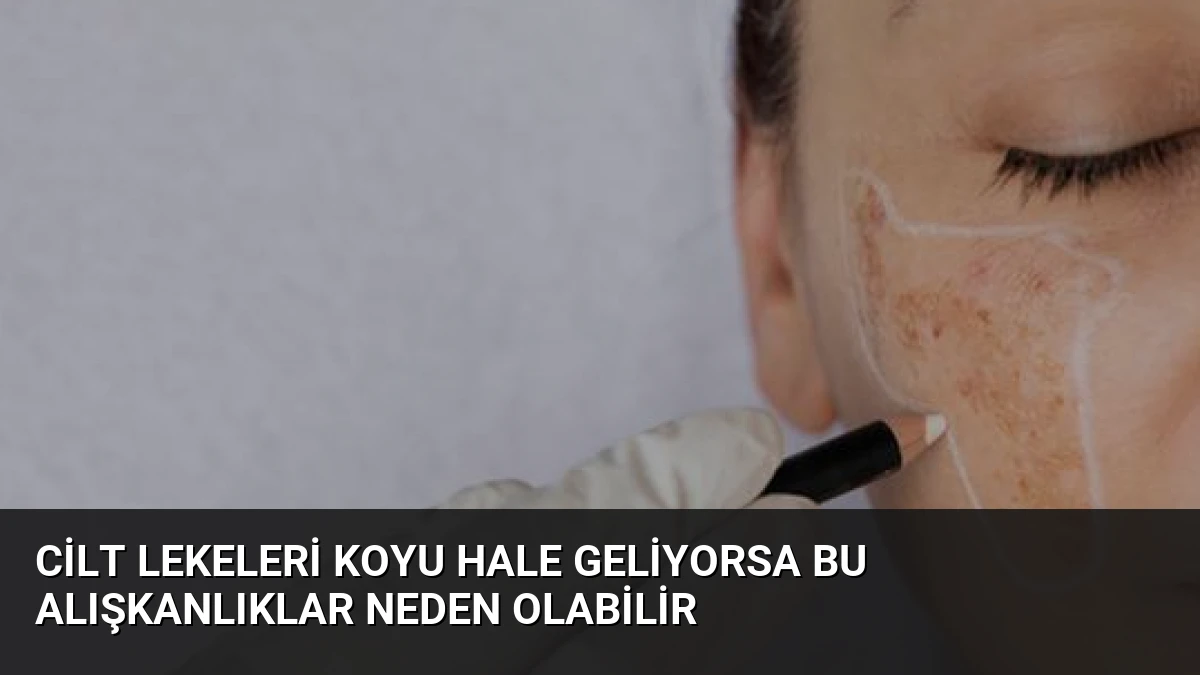 Cilt Lekeleri Koyu Hale Geliyorsa Bu Alışkanlıklar Neden Olabilir