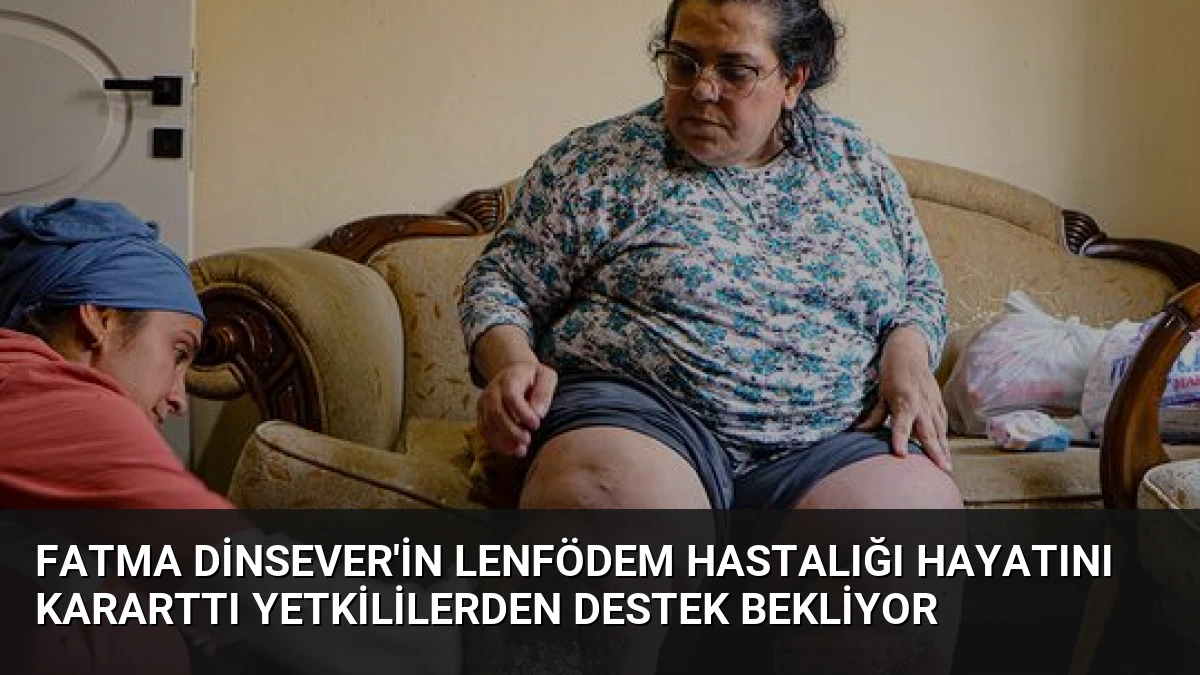 Fatma Dinsever’in Lenfödem Hastalığı Hayatını Kararttı Yetkililerden Destek Bekliyor
