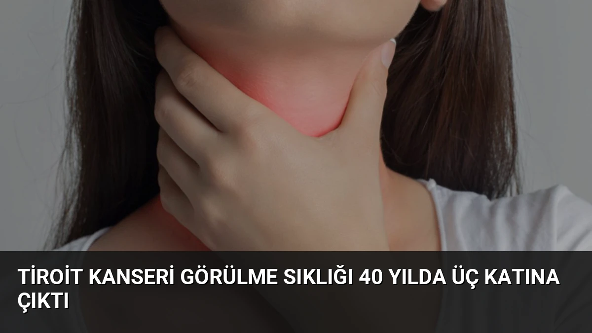 Tiroit Kanseri Görülme Sıklığı 40 Yılda Üç Katına Çıktı