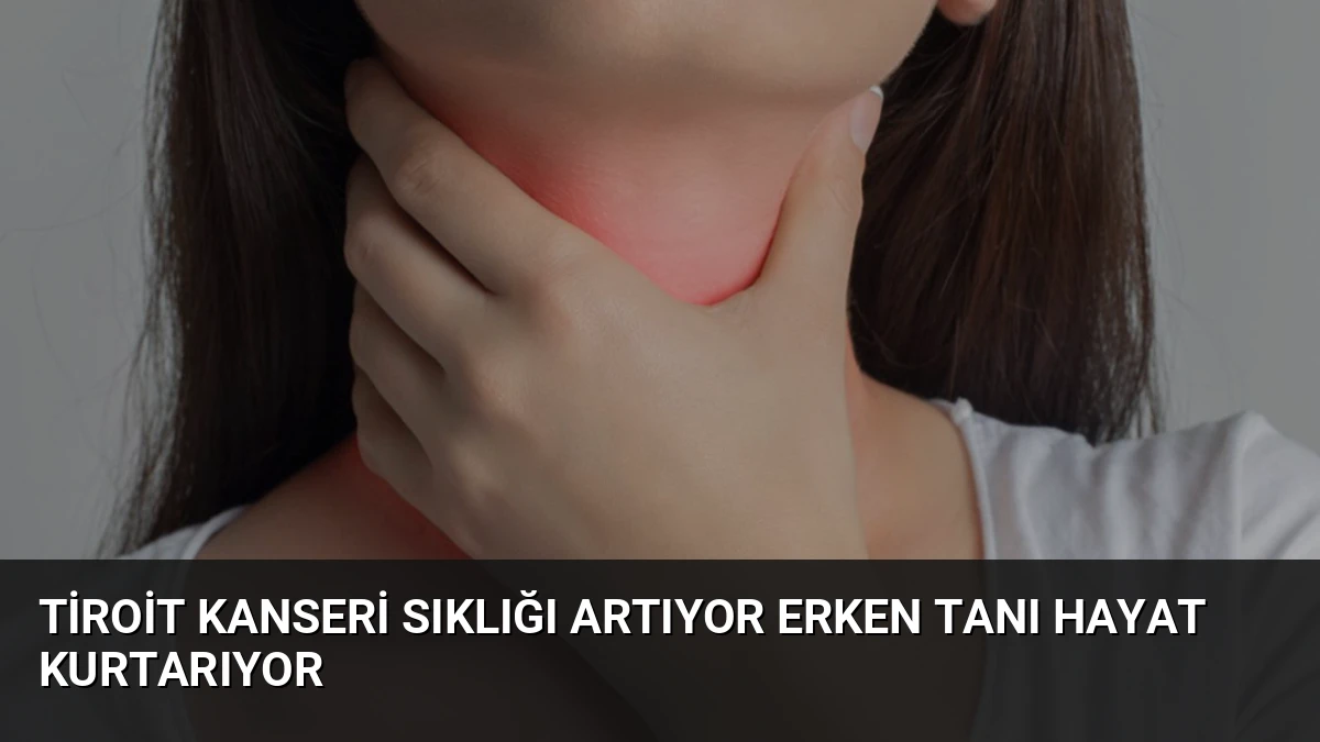 Tiroit Kanseri Sıklığı Artıyor Erken Tanı Hayat Kurtarıyor